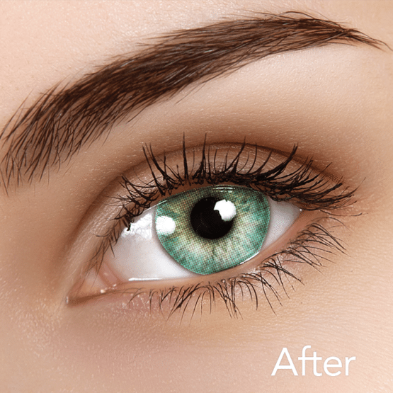 ISODA Sky Contacts